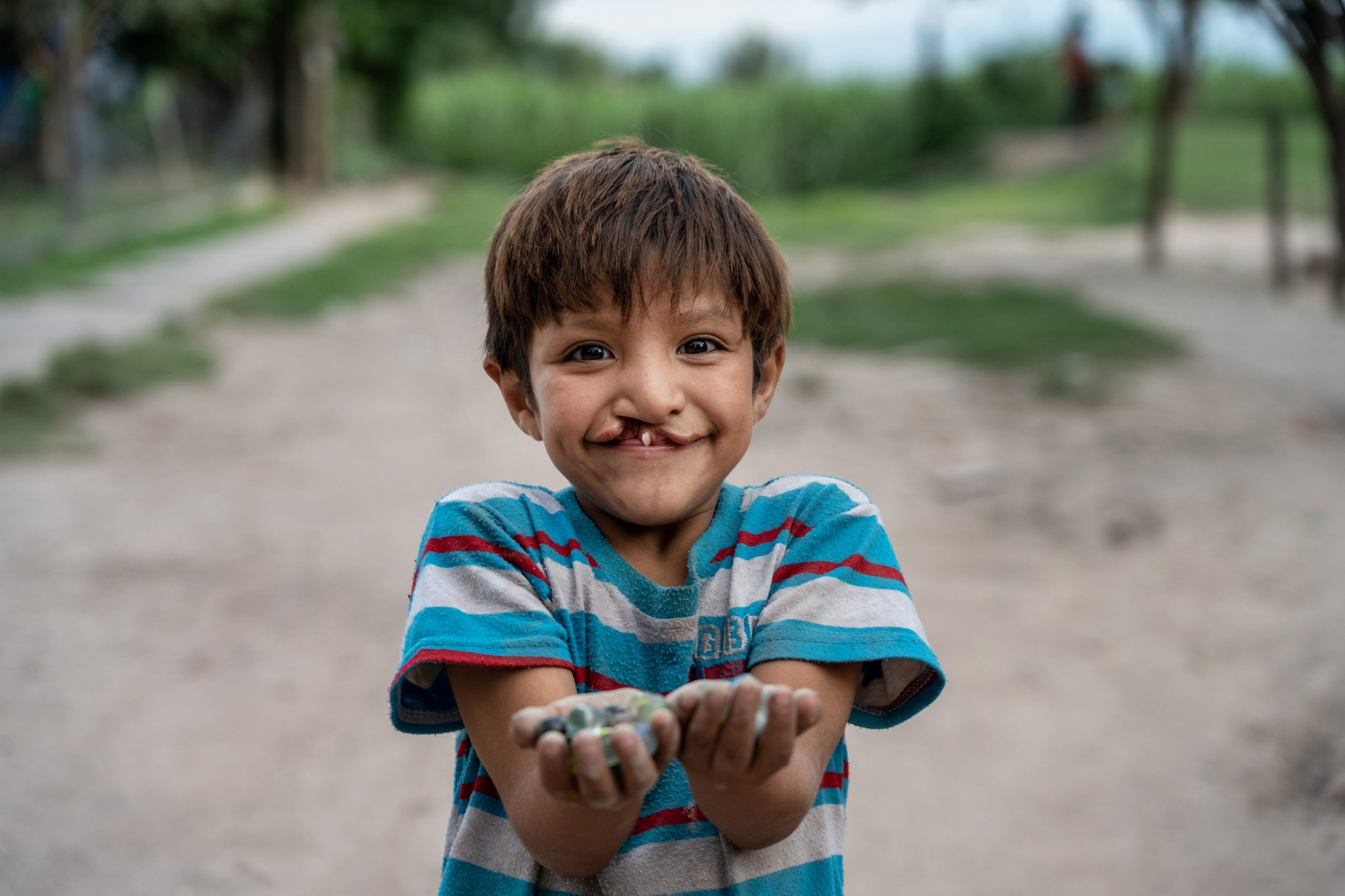 Samir, el chico tucumano con fisura labio palatina al que dos cirugías le devolvieron la sonrisa y el futuro